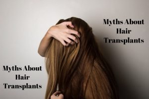 5 Myths About Hair Transplants From A NYC Hair Transplant Surgeon