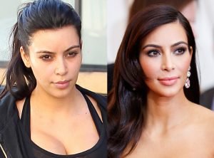 Celebrity’s Best Kept Secret to Tighten Saggy Skin on Neck