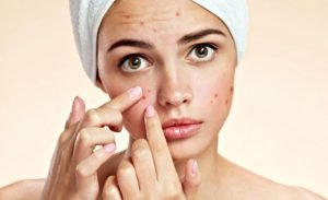 Fight Against Acne by Using Retin a Gel 0.1 and Tretinoin Gel 0.1 Menarini